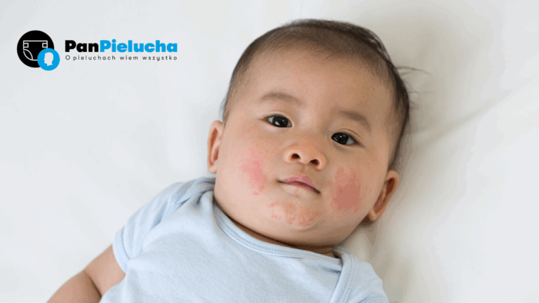 Problemy skórne u niemowląt